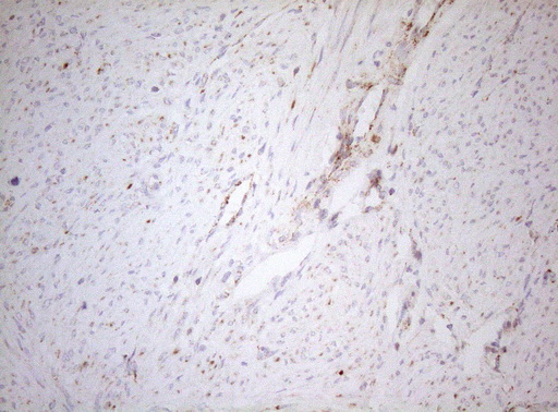 DECR1 Antibody - Immunohistochemical staining of paraffin-embedded Human endometrium tissue within the normal limits using anti-DECR1 mouse monoclonal antibody. (Heat-induced epitope retrieval by 1mM EDTA in 10mM Tris buffer. (pH8.5) at 120°C for 3 min. (1:150)