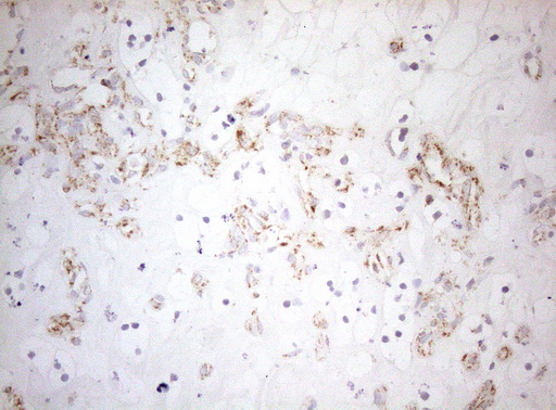 DECR1 Antibody - Immunohistochemical staining of paraffin-embedded Human Kidney tissue within the normal limits using anti-DECR1 mouse monoclonal antibody. (Heat-induced epitope retrieval by 1mM EDTA in 10mM Tris buffer. (pH8.5) at 120°C for 3 min. (1:150)