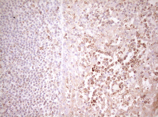 DECR1 Antibody - Immunohistochemical staining of paraffin-embedded Human tonsil within the normal limits using anti-DECR1 mouse monoclonal antibody. (Heat-induced epitope retrieval by 1mM EDTA in 10mM Tris buffer. (pH8.5) at 120°C for 3 min. (1:150)