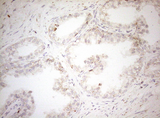 DECR1 Antibody - Immunohistochemical staining of paraffin-embedded Human prostate tissue within the normal limits using anti-DECR1 mouse monoclonal antibody. (Heat-induced epitope retrieval by 1mM EDTA in 10mM Tris buffer. (pH8.5) at 120°C for 3 min. (1:150)