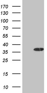 DECR1 Antibody - HEK293T cells were transfected with the pCMV6-ENTRY control. (Left lane) or pCMV6-ENTRY DECR1. (Right lane) cDNA for 48 hrs and lysed. Equivalent amounts of cell lysates. (5 ug per lane) were separated by SDS-PAGE and immunoblotted with anti-DECR1. (1:2000)