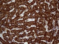 DECR1 Antibody - Immunohistochemical staining of paraffin-embedded Human liver tissue within the normal limits using anti-DECR1 mouse monoclonal antibody. (Heat-induced epitope retrieval by 1mM EDTA in 10mM Tris buffer. (pH8.5) at 120°C for 3 min. (1:150)