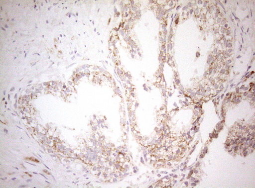 DECR1 Antibody - Immunohistochemical staining of paraffin-embedded Human prostate tissue within the normal limits using anti-DECR1 mouse monoclonal antibody. (Heat-induced epitope retrieval by 1mM EDTA in 10mM Tris buffer. (pH8.5) at 120°C for 3 min. (1:150)