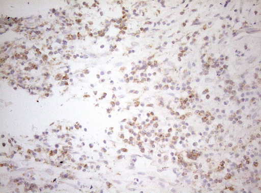 DECR1 Antibody - Immunohistochemical staining of paraffin-embedded Human lymph node tissue within the normal limits using anti-DECR1 mouse monoclonal antibody. (Heat-induced epitope retrieval by 1mM EDTA in 10mM Tris buffer. (pH8.5) at 120°C for 3 min. (1:150)