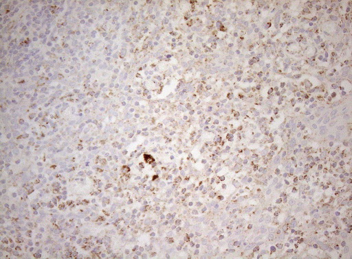 DECR1 Antibody - Immunohistochemical staining of paraffin-embedded Human tonsil within the normal limits using anti-DECR1 mouse monoclonal antibody. (Heat-induced epitope retrieval by 1mM EDTA in 10mM Tris buffer. (pH8.5) at 120°C for 3 min. (1:150)