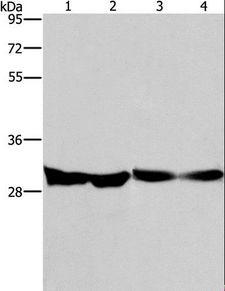 DECR1 Antibody - Western blot analysis of Human endometrial carcinoma and colon cancer tissue, mouse heart tissue and PC3 cell, using DECR1 Polyclonal Antibody at dilution of 1:300.