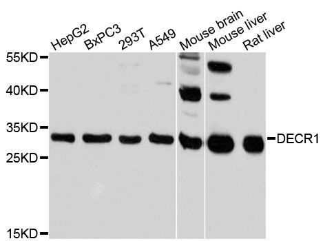 DECR1 Antibody - Western blot analysis of extracts of various cell lines, using DECR1 antibody at 1:3000 dilution. The secondary antibody used was an HRP Goat Anti-Rabbit IgG (H+L) at 1:10000 dilution. Lysates were loaded 25ug per lane and 3% nonfat dry milk in TBST was used for blocking. An ECL Kit was used for detection and the exposure time was 30s.