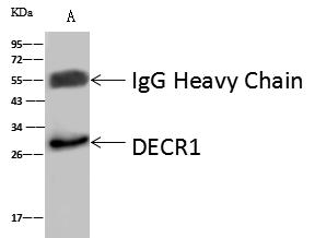 DECR1 Antibody - DECR1 was immunoprecipitated using: Lane A: 0.5 mg PC3 Whole Cell Lysate. 4 uL anti-DECR1 rabbit polyclonal antibody and 60 ug of Immunomagnetic beads Protein A/G. Primary antibody: Anti-DECR1 rabbit polyclonal antibody, at 1:100 dilution. Secondary antibody: Goat Anti-Rabbit IgG (H+L)/HRP at 1/10000 dilution. Developed using the ECL technique. Performed under reducing conditions. Predicted band size: 36 kDa. Observed band size: 30 kDa.