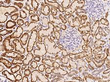 DECR1 Antibody - Immunochemical staining of human DECR1 in human kidney with rabbit polyclonal antibody at 1:1000 dilution, formalin-fixed paraffin embedded sections.