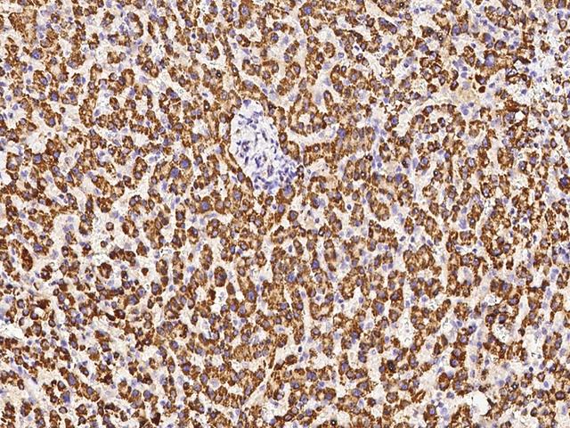 DECR1 Antibody - Immunochemical staining of human DECR1 in human liver with rabbit polyclonal antibody at 1:1000 dilution, formalin-fixed paraffin embedded sections.