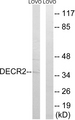 DECR2 Antibody - Western blot analysis of lysates from LOVO cells, using DECR2 Antibody. The lane on the right is blocked with the synthesized peptide.
