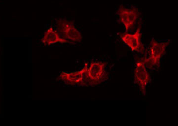 DECR2 Antibody - Staining LOVO cells by IF/ICC. The samples were fixed with PFA and permeabilized in 0.1% Triton X-100, then blocked in 10% serum for 45 min at 25°C. The primary antibody was diluted at 1:200 and incubated with the sample for 1 hour at 37°C. An Alexa Fluor 594 conjugated goat anti-rabbit IgG (H+L) Ab, diluted at 1/600, was used as the secondary antibody.