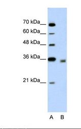 DECR2 Antibody - Lane A: Marker. Lane B: Jurkat cell lysate. Antibody concentration: 5.0 ug/ml. Gel concentration: 12%.  This image was taken for the unconjugated form of this product. Other forms have not been tested.