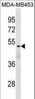 DEDD Antibody - DEDD Antibody western blot of MDA-MB453 cell line lysates (35 ug/lane). The DEDD antibody detected the DEDD protein (arrow).