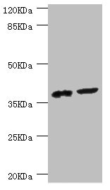 DEDD Antibody - Western blot All Lanes:DEDD antibody at 0.56ug/ml Lane 1:mouse lung tissue Lane 2:mouse thymus tissue Secondary Goat polyclonal to rabbit at 1/10000 dilution Predicted band size: 37,41 kDa Observed band size: 36 kDa