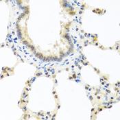 DEDD Antibody - Immunohistochemistry of paraffin-embedded Rat lung using DEDD Polyclonal Antibody at dilution of 1:100 (40x lens).