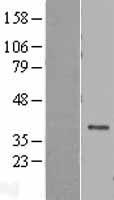 DEDD Protein - Western validation with an anti-DDK antibody * L: Control HEK293 lysate R: Over-expression lysate