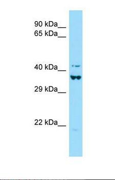 DEF6 Antibody - Western blot of Human 293T. DEF6 antibody dilution 1.0 ug/ml.  This image was taken for the unconjugated form of this product. Other forms have not been tested.