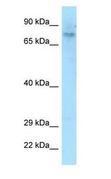 DEF6 Antibody - DEF6 antibody Western Blot of U937.  This image was taken for the unconjugated form of this product. Other forms have not been tested.