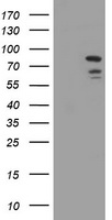 DEF6 Antibody - HEK293T cells were transfected with the pCMV6-ENTRY control (Left lane) or pCMV6-ENTRY DEF6 (Right lane) cDNA for 48 hrs and lysed. Equivalent amounts of cell lysates (5 ug per lane) were separated by SDS-PAGE and immunoblotted with anti-DEF6.