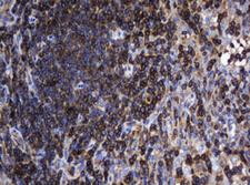DEF6 Antibody - IHC of paraffin-embedded Human lymph node tissue using anti-DEF6 mouse monoclonal antibody. (Heat-induced epitope retrieval by 10mM citric buffer, pH6.0, 120°C for 3min).