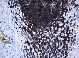 DEF6 Antibody - IHC of paraffin-embedded Human tonsil using anti-DEF6 mouse monoclonal antibody. (Heat-induced epitope retrieval by 10mM citric buffer, pH6.0, 120°C for 3min).