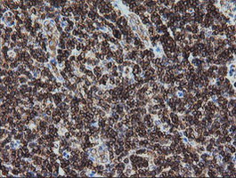 DEF6 Antibody - IHC of paraffin-embedded Human tonsil using anti-DEF6 mouse monoclonal antibody. (Heat-induced epitope retrieval by 10mM citric buffer, pH6.0, 100C for 10min).
