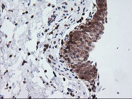 DEF6 Antibody - IHC of paraffin-embedded Human bladder tissue using anti-DEF6 mouse monoclonal antibody.