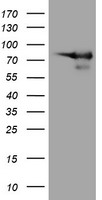 DEF6 Antibody - HEK293T cells were transfected with the pCMV6-ENTRY control (Left lane) or pCMV6-ENTRY DEF6 (Right lane) cDNA for 48 hrs and lysed. Equivalent amounts of cell lysates (5 ug per lane) were separated by SDS-PAGE and immunoblotted with anti-DEF6.