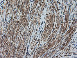 DEF6 Antibody - IHC of paraffin-embedded Human endometrium tissue using anti-DEF6 mouse monoclonal antibody. (Heat-induced epitope retrieval by 10mM citric buffer, pH6.0, 100C for 10min).