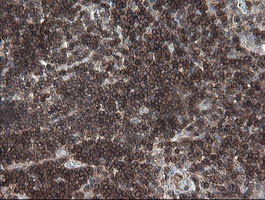 DEF6 Antibody - IHC of paraffin-embedded Human tonsil using anti-DEF6 mouse monoclonal antibody. (Heat-induced epitope retrieval by 10mM citric buffer, pH6.0, 100C for 10min).