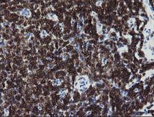 DEF6 Antibody - IHC of paraffin-embedded Human tonsil using anti-DEF6 mouse monoclonal antibody.