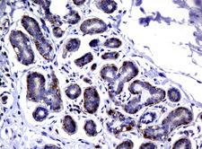 DEF6 Antibody - Immunohistochemical staining of paraffin-embedded Human breast tissue using anti-DEF6 mouse monoclonal antibody.  heat-induced epitope retrieval by 10mM citric buffer, pH6.0, 120C for 3min)