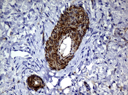 DEF6 Antibody - Immunohistochemical staining of paraffin-embedded Human Ovary tissue using anti-DEF6 mouse monoclonal antibody.  heat-induced epitope retrieval by 10mM citric buffer, pH6.0, 120C for 3min)