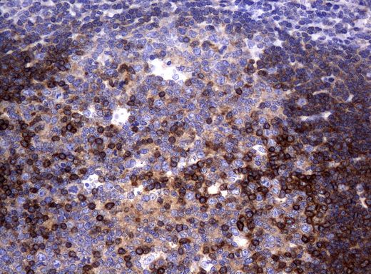 DEF6 Antibody - Immunohistochemical staining of paraffin-embedded Human tonsil using anti-DEF6mouse monoclonal antibody.  heat-induced epitope retrieval by 10mM citric buffer, pH6.0, 120C for 3min)
