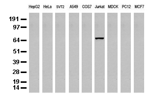 DEF6 Antibody - Western blot analysis of extracts. (35ug) from 9 different cell lines by using anti-DEF6 monoclonal antibody. (Clone UMAB51).