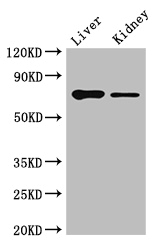 DEF6 Antibody - Positive WB detected in:Mouse liver tissue,Mouse kidney tissue;All lanes:DEF6 antibody at 4ug/ml;Secondary;Goat polyclonal to rabbit IgG at 1/50000 dilution;Predicted band size: 74 kDa;Observed band size: 74 kDa;