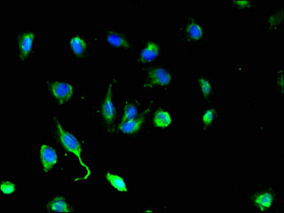 DEF6 Antibody - Immunofluorescent analysis of U251 cells using DEF6 Antibody at a dilution of 1:100 and Alexa Fluor 488-congugated AffiniPure Goat Anti-Rabbit IgG(H+L)