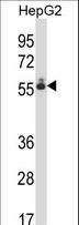 DEF8 Antibody - DEF8 Antibody western blot of HepG2 cell line lysates (35 ug/lane). The DEF8 antibody detected the DEF8 protein (arrow).