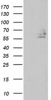 DEF8 Antibody - HEK293T cells were transfected with the pCMV6-ENTRY control (Left lane) or pCMV6-ENTRY DEF8 (Right lane) cDNA for 48 hrs and lysed. Equivalent amounts of cell lysates (5 ug per lane) were separated by SDS-PAGE and immunoblotted with anti-DEF8.
