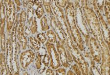 DEFA1 + DEFA3 Antibody - 1:100 staining mouse kidney tissue by IHC-P. The sample was formaldehyde fixed and a heat mediated antigen retrieval step in citrate buffer was performed. The sample was then blocked and incubated with the antibody for 1.5 hours at 22°C. An HRP conjugated goat anti-rabbit antibody was used as the secondary.