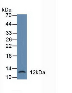DEFA1 / Defensin Alpha 1 Antibody - Western Blot; Sample: Human Liver Tissue.