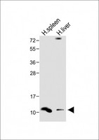 DEFA1 / Defensin Alpha 1 Antibody - All lanes: Anti-DEFA1 Antibody (Center) at 1:1000 dilution Lane 1: Human spleen lysate Lane 2: Human liver lysate Lysates/proteins at 20 µg per lane. Secondary Goat Anti-Rabbit IgG, (H+L), Peroxidase conjugated at 1/10000 dilution. Predicted band size: 10 kDa Blocking/Dilution buffer: 5% NFDM/TBST.