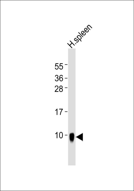 DEFA1 / Defensin Alpha 1 Antibody - Anti-Defensin alpha 1 Antibody at 1:1000 dilution + human spleen lysates Lysates/proteins at 20 ug per lane. Secondary Goat Anti-Rabbit IgG, (H+L),Peroxidase conjugated at 1/10000 dilution Predicted band size : 10 kDa Blocking/Dilution buffer: 5% NFDM/TBST.