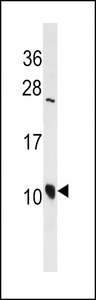 DEFA3 / Defensin Alpha 3 Antibody - DEFA3 Antibody western blot of Jurkat cell line lysates (35 ug/lane). The DEFA3 antibody detected the DEFA3 protein (arrow).