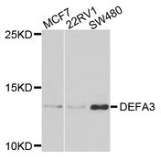 DEFA3 / Defensin Alpha 3 Antibody - Western blot analysis of extracts of various cells.