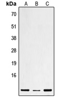 DEFB1 / BD-1 Antibody - Western blot analysis of Defensin beta 1 expression in HEK293T (A); mouse liver (B); rat heart (C) whole cell lysates.