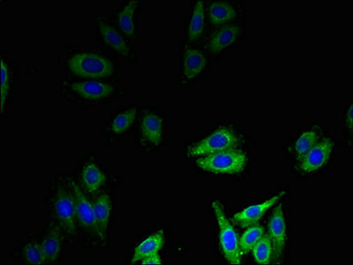DEFB1 / BD-1 Antibody - Immunofluorescent analysis of HepG2 cells using DEFB1 Antibody at dilution of 1:100 and Alexa Fluor 488-congugated AffiniPure Goat Anti-Rabbit IgG(H+L)