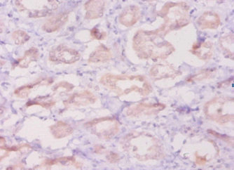 DEFB1 / BD-1 Antibody - Immunohistochemistry of paraffin-embedded human kidney tissue using DEFB1 Antibody at dilution of 1:50