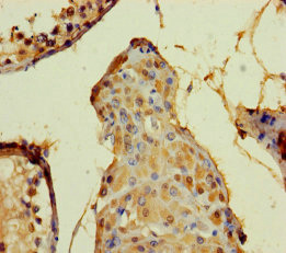 DEFB104A / BD-4 Antibody - Immunohistochemistry of paraffin-embedded human testis tissue using DEFB104A Antibody at dilution of 1:100